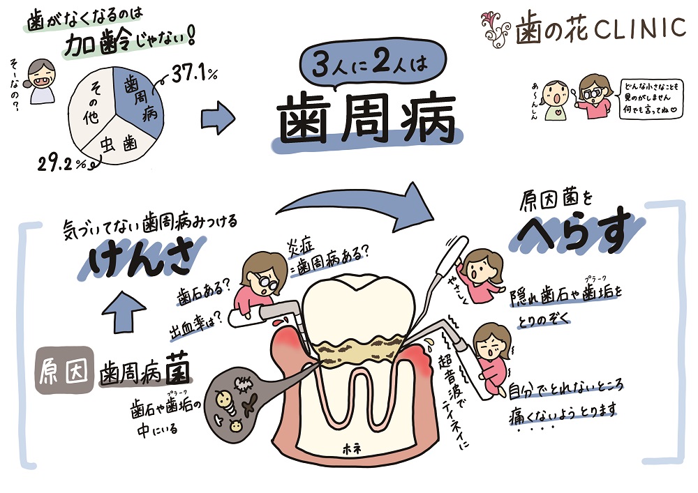 歯の花クリニックの歯周病治療