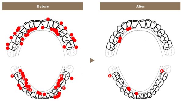 CASE④「2年前から出血が続いていたが、どこに行っても改善せず…」57歳・女性